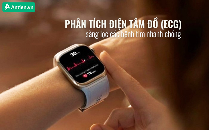 ECg cho phép người dùng theo dõi nhịp tim và phát hiện các dấu hiệu bất thường